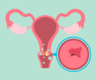 HPV-Rahim Ağzı Kanseri Farkındalığı Projemiz Başlıyor